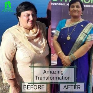 Weight Loss Transformation Results